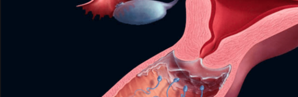 O Que E Como Tratar O Muco Cervical Hostil