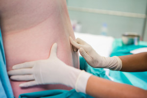 tipos de anestesia para parto