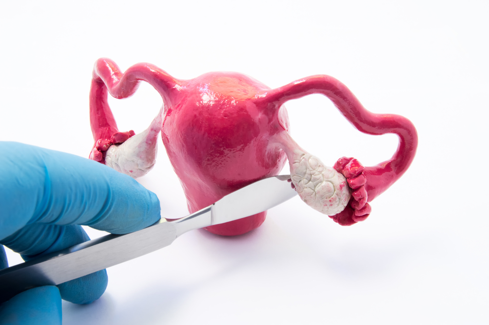 Médico utiliza pinça para encostar em ovário falso