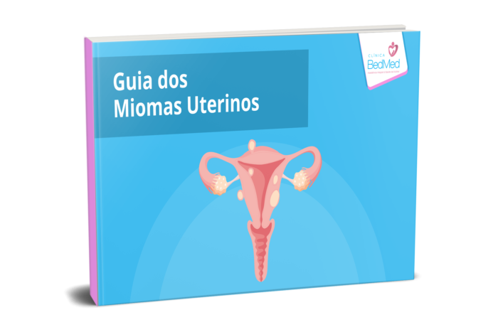 Guia Completo sobre os Miomas Uterinos