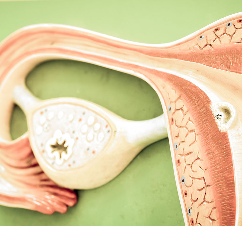 Integra Cirurgia - A remoção de um ou dos dois ovários, chama-se