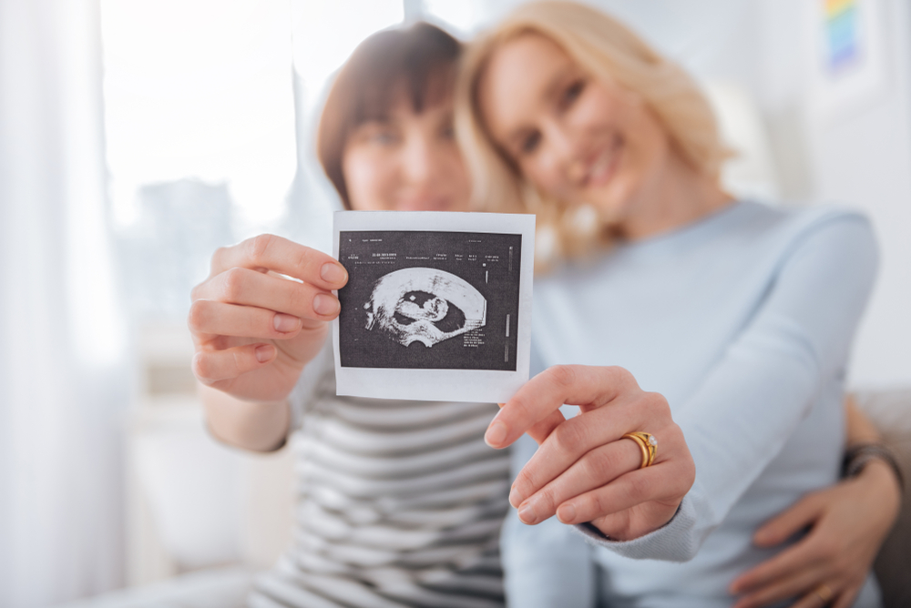 Casal de mulheres segurando um ultrassom