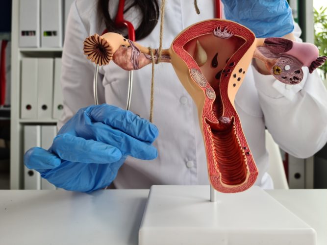 Médica segurando um útero falso