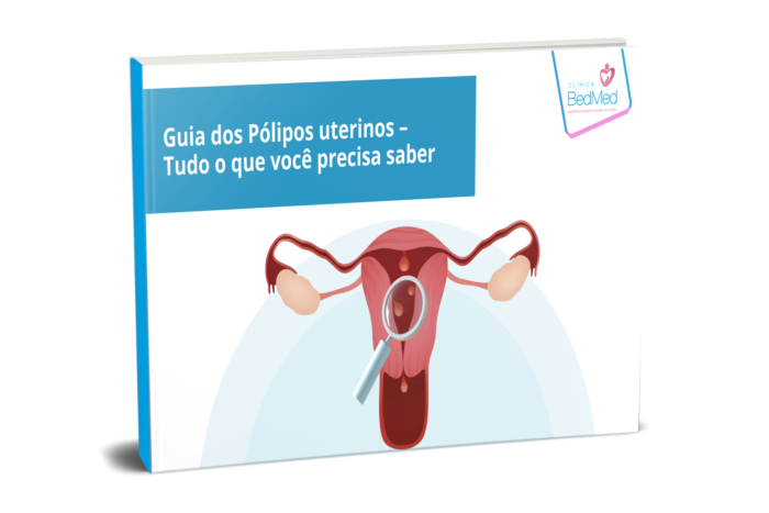 Guia dos Pólipos Uterinos – Tudo o que você precisa saber