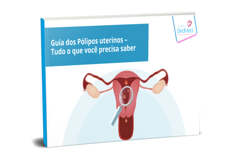 Videolaparoscopia Cirúrgica - BedMed