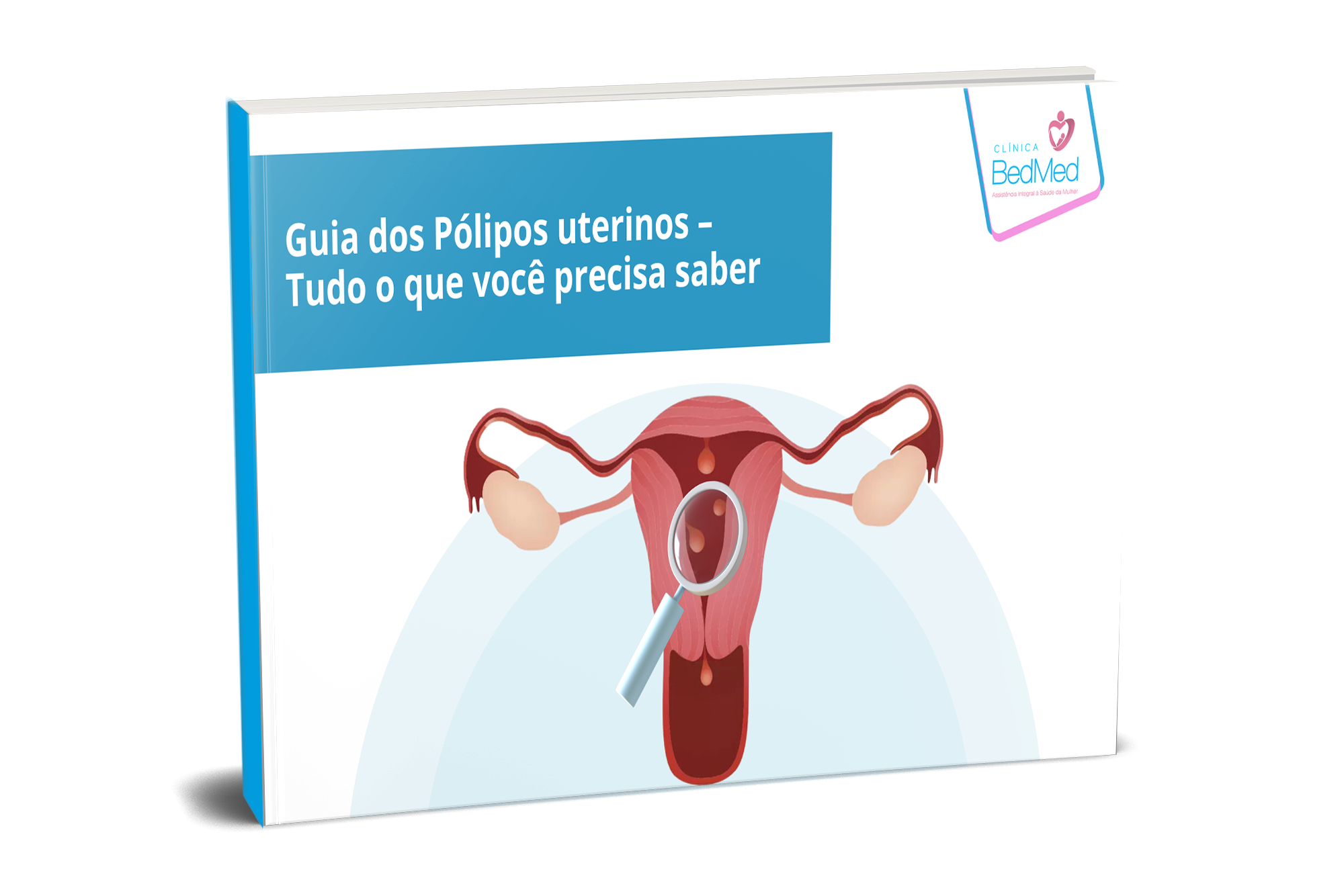 Guia dos Pólipos Uterinos – Tudo o que você precisa saber