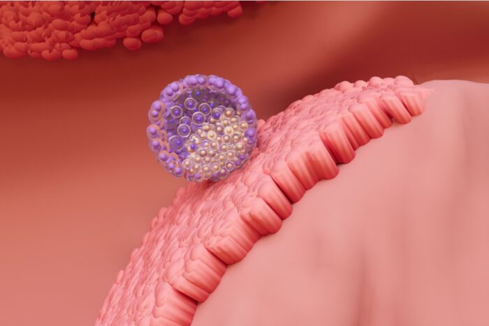 Imagem ilustrativa de implantação de embrião na parede endometrial.