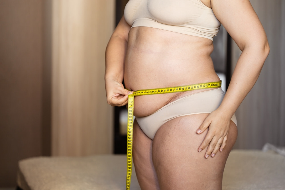 Mulher acima do peso medindo barriga com fita métrica.