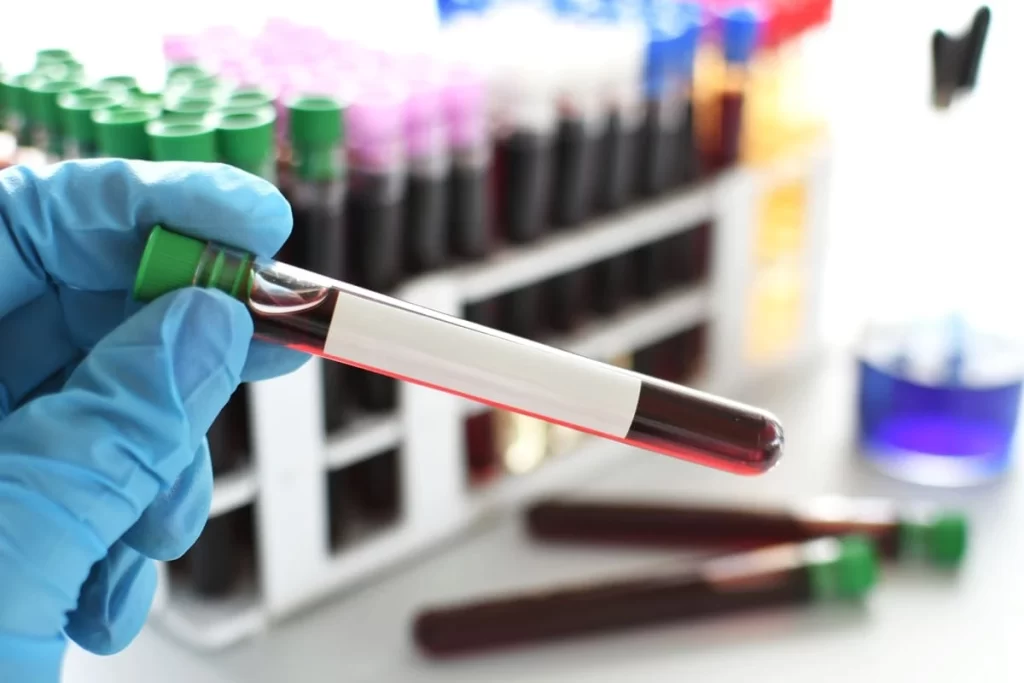 Mão segurando tubo de sangue ilustrando coleta para exame de estradiol.